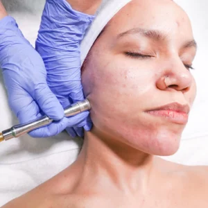 Facial treatment